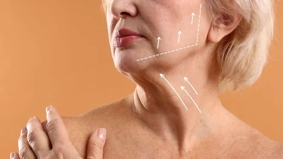 Când pielea lăsată de pe gât nu mai poate fi corectată cu proceduri estetice. Semnele că poate fi nevoie de lifting cervical